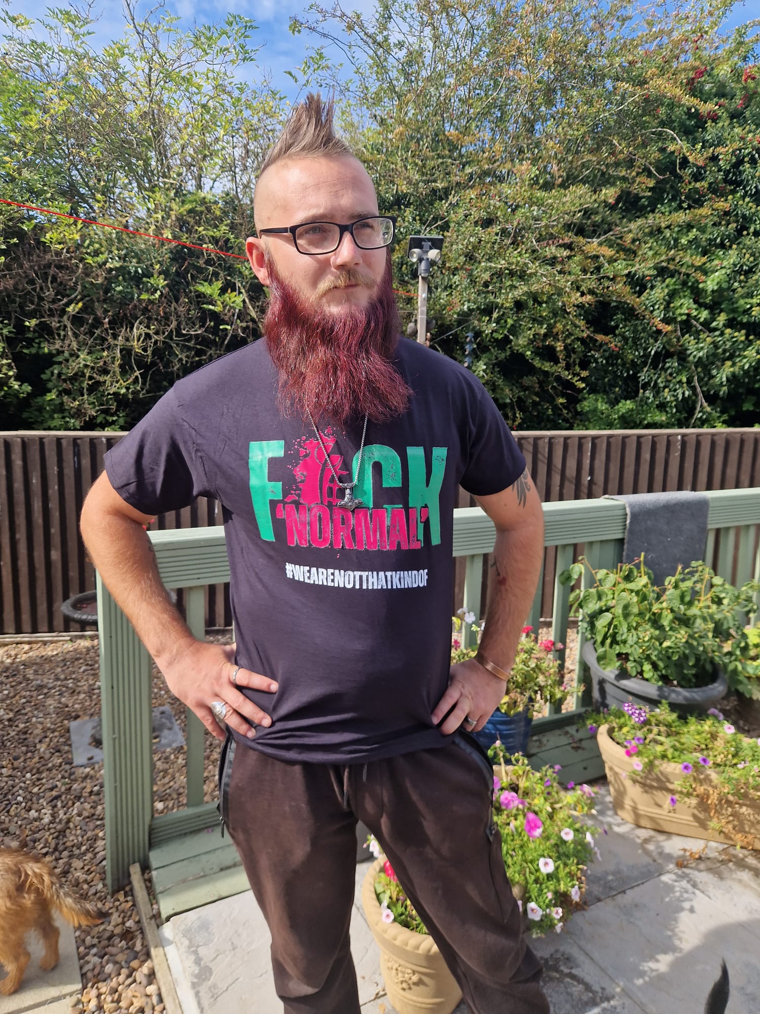FCK Normal T-Shirt - Black - Image 3